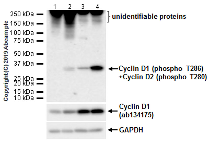 Western blot - Anti-Cyclin D1 (phospho T286) + Cyclin D2 (phospho T280) antibody [EPR22328-235] (AB230818)