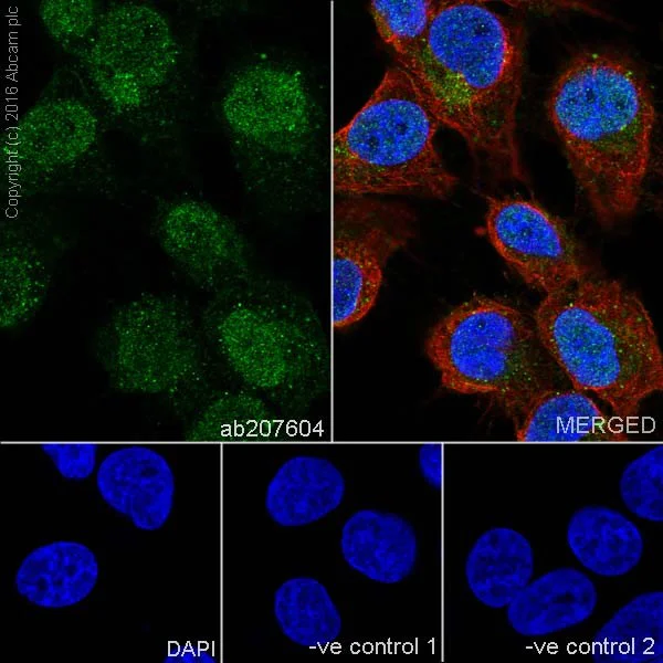 Immunocytochemistry/ Immunofluorescence - Anti-Cyclin D2 antibody [EPR19659] (AB207604)
