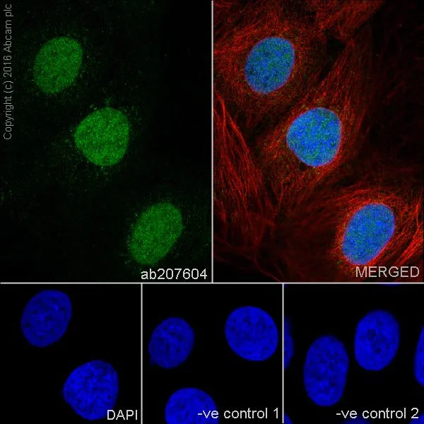 Immunocytochemistry/ Immunofluorescence - Anti-Cyclin D2 antibody [EPR19659] (AB207604)
