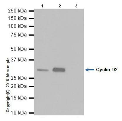 Immunoprecipitation - Anti-Cyclin D2 antibody [EPR19659] (AB207604)