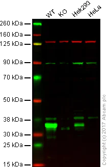 Western blot - Anti-Cyclin D2 antibody [EPR19659] (AB207604)