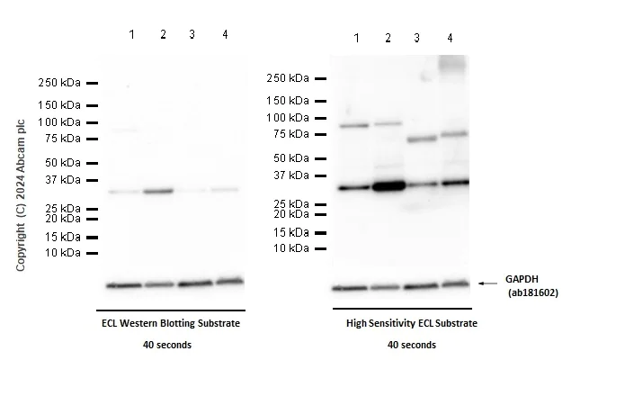 Western blot - Anti-Cyclin D2 antibody [EPR19659] (AB207604)