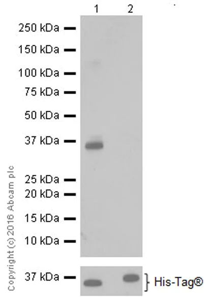Western blot - Anti-Cyclin D2 antibody [EPR19659] (AB207604)