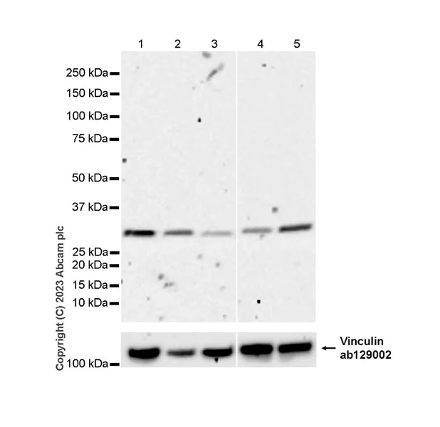 Western blot - Anti-Cyclin D2 antibody [EPR27468-62] (AB308258)
