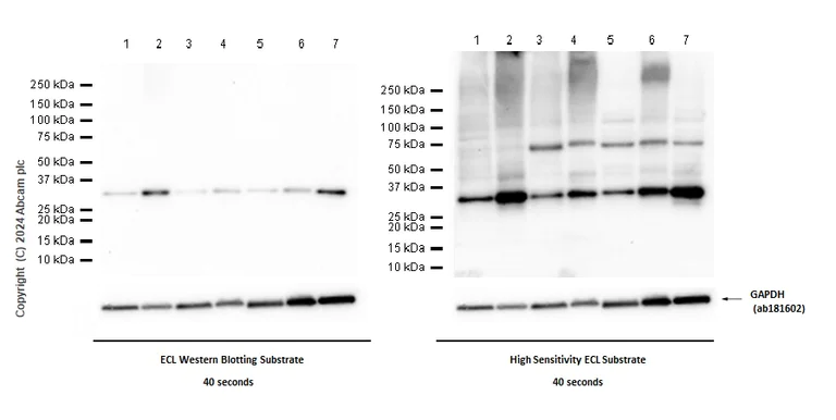 Western blot - Anti-Cyclin D2 antibody [EPR27468-62] - BSA and Azide free (AB308259)