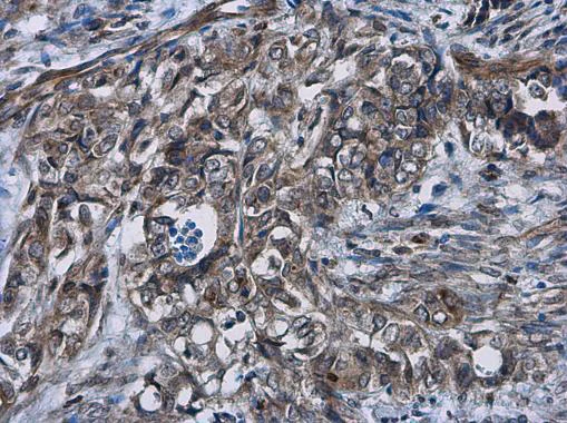 Immunohistochemistry (Formalin/PFA-fixed paraffin-embedded sections) - Anti-Cyclin D2 antibody - N-terminal (AB226972)