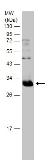 Western blot - Anti-Cyclin D2 antibody - N-terminal (AB226972)