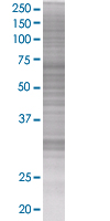 Cyclin D2 overexpression 293T lysate (whole cell)
