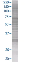 SDS-PAGE - Cyclin D2 overexpression 293T lysate (whole cell) (AB94090)