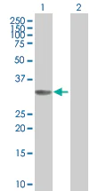 Western blot - Cyclin D2 overexpression 293T lysate (whole cell) (AB94090)
