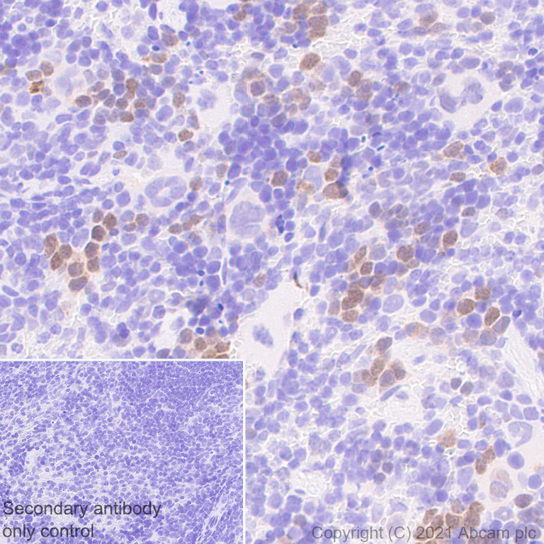 Immunohistochemistry (Formalin/PFA-fixed paraffin-embedded sections) - Anti-Cyclin D3/CCND3 antibody [1/Cyclin D3] - BSA and Azide free (AB289556)