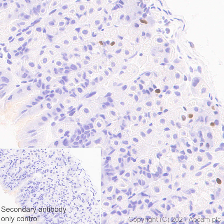 Immunohistochemistry (Formalin/PFA-fixed paraffin-embedded sections) - Anti-Cyclin D3/CCND3 antibody [1/Cyclin D3] - BSA and Azide free (AB289556)