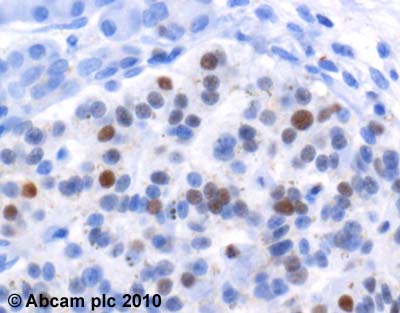 Immunohistochemistry (Formalin/PFA-fixed paraffin-embedded sections) - Anti-Cyclin D3/CCND3 antibody [DCS2.2] (AB28283)