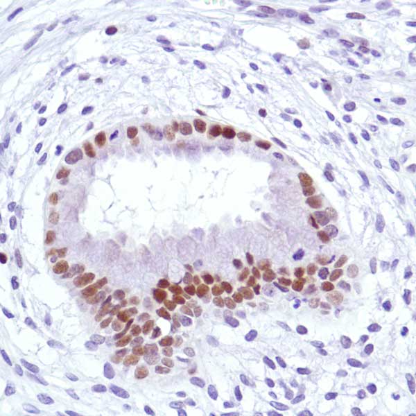 Immunohistochemistry (Formalin/PFA-fixed paraffin-embedded sections) - Anti-Cyclin D3/CCND3 antibody [SP207] (ab183338), expandable thumbnail