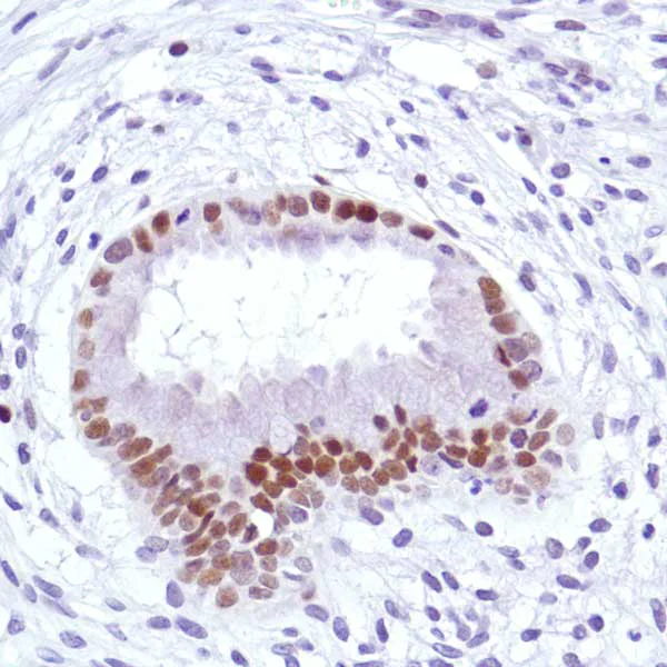 Immunohistochemistry (Formalin/PFA-fixed paraffin-embedded sections) - Anti-Cyclin D3/CCND3 antibody [SP207] (AB183338)