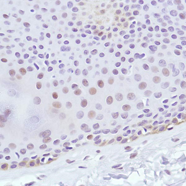 Immunohistochemistry (Formalin/PFA-fixed paraffin-embedded sections) - Anti-Cyclin D3/CCND3 antibody [SP207] (ab183338), expandable thumbnail