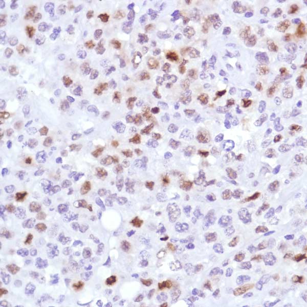 Immunohistochemistry (Formalin/PFA-fixed paraffin-embedded sections) - Anti-Cyclin D3/CCND3 antibody [SP207] (ab183338), expandable thumbnail