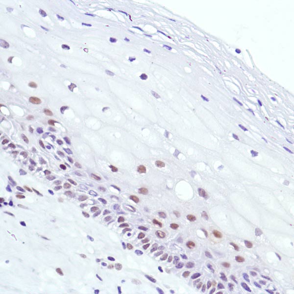 Immunohistochemistry (Formalin/PFA-fixed paraffin-embedded sections) - Anti-Cyclin D3/CCND3 antibody [SP207] (ab183338), expandable thumbnail