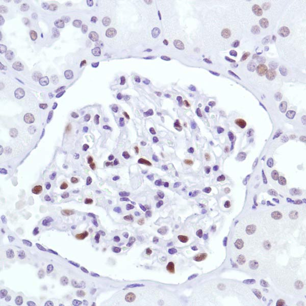 Immunohistochemistry (Formalin/PFA-fixed paraffin-embedded sections) - Anti-Cyclin D3/CCND3 antibody [SP207] (ab183338), expandable thumbnail