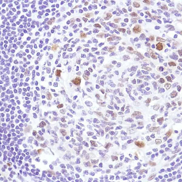 Immunohistochemistry (Formalin/PFA-fixed paraffin-embedded sections) - Anti-Cyclin D3/CCND3 antibody [SP207] (AB183338), expandable thumbnail