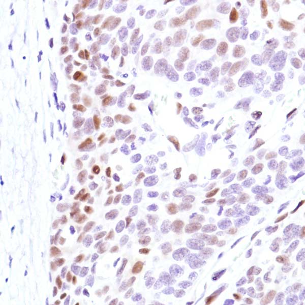 Immunohistochemistry (Formalin/PFA-fixed paraffin-embedded sections) - Anti-Cyclin D3/CCND3 antibody [SP207] (AB183338), expandable thumbnail