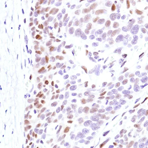 Immunohistochemistry (Formalin/PFA-fixed paraffin-embedded sections) - Anti-Cyclin D3/CCND3 antibody [SP207] (AB183338)