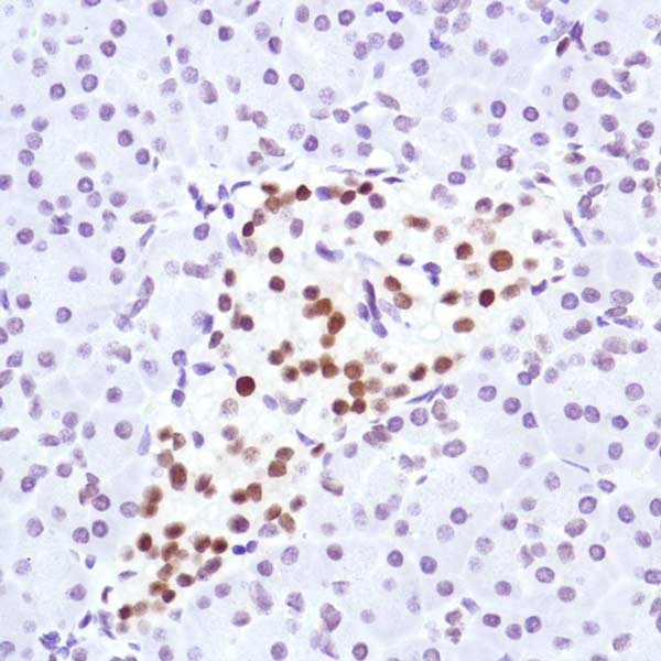 Immunohistochemistry (Formalin/PFA-fixed paraffin-embedded sections) - Anti-Cyclin D3/CCND3 antibody [SP207] (ab183338), expandable thumbnail
