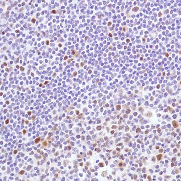 Immunohistochemistry (Formalin/PFA-fixed paraffin-embedded sections) - Anti-Cyclin D3/CCND3 antibody [SP207] (ab183338), expandable thumbnail