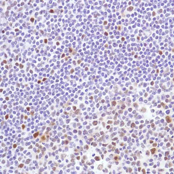 Immunohistochemistry (Formalin/PFA-fixed paraffin-embedded sections) - Anti-Cyclin D3/CCND3 antibody [SP207] (AB183338)