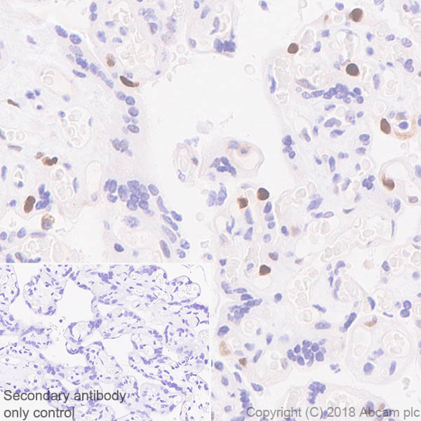 Immunohistochemistry (Formalin/PFA-fixed paraffin-embedded sections) - Anti-Cyclin D3/CCND3 antibody [SP207] (AB183338), expandable thumbnail