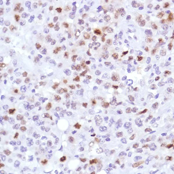 Immunohistochemistry (Formalin/PFA-fixed paraffin-embedded sections) - Anti-Cyclin D3/CCND3 antibody [SP207] - BSA and Azide free (AB245734)
