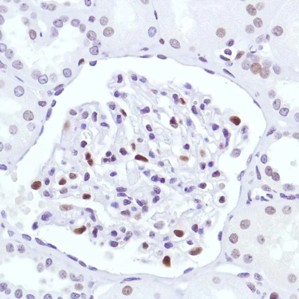 Immunohistochemistry (Formalin/PFA-fixed paraffin-embedded sections) - Anti-Cyclin D3/CCND3 antibody [SP207] - BSA and Azide free (AB245734)