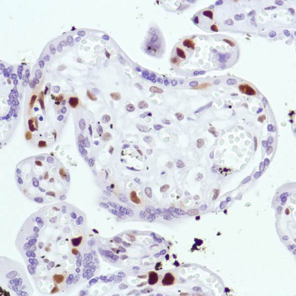 Immunohistochemistry (Formalin/PFA-fixed paraffin-embedded sections) - Anti-Cyclin D3/CCND3 antibody [SP207] - BSA and Azide free (AB245734)