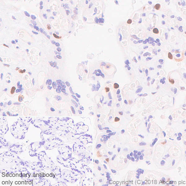 Immunohistochemistry (Formalin/PFA-fixed paraffin-embedded sections) - Anti-Cyclin D3/CCND3 antibody [SP207] - BSA and Azide free (AB245734)