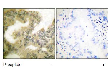 Immunohistochemistry (Formalin/PFA-fixed paraffin-embedded sections) - Anti-Cyclin D3/CCND3 (phospho T283) antibody (AB55322)