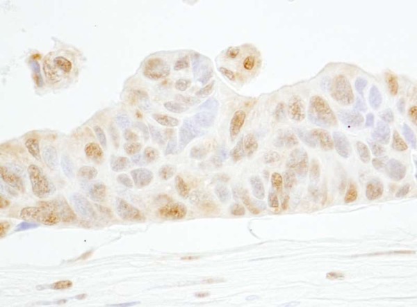 Immunohistochemistry (Formalin/PFA-fixed paraffin-embedded sections) - Anti-Cyclin E1 antibody (AB224819)
