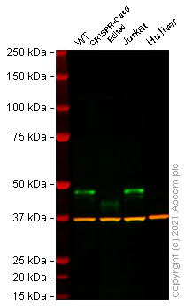 Western blot - Anti-Cyclin E1 antibody [CCNE1/2460] (AB238081)