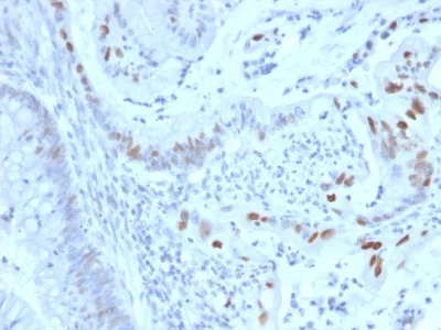 Immunohistochemistry (Formalin/PFA-fixed paraffin-embedded sections) - Anti-Cyclin E1 antibody [CCNE1/2460] - BSA and Azide free (AB237935)