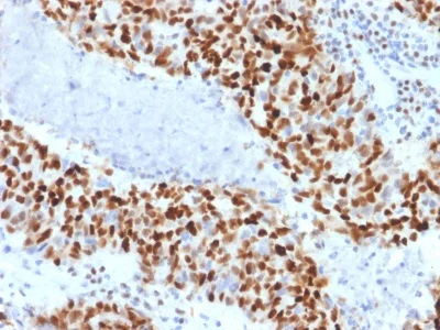 Immunohistochemistry (Formalin/PFA-fixed paraffin-embedded sections) - Anti-Cyclin E1 antibody [CCNE1/2460] - BSA and Azide free (AB237935)