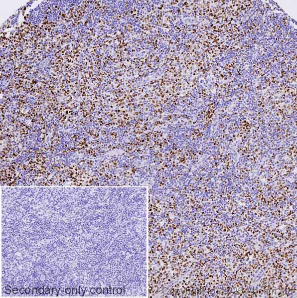 Immunohistochemistry (Formalin/PFA-fixed paraffin-embedded sections) - Anti-Cyclin E1 antibody [CCNE1/2460] - BSA and Azide free (AB237935)