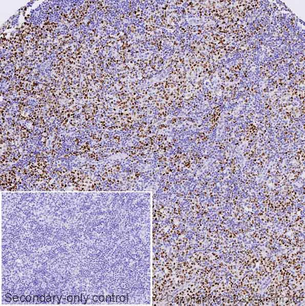 Immunohistochemistry (Formalin/PFA-fixed paraffin-embedded sections) - Anti-Cyclin E1 antibody [CCNE1/2460] - BSA and Azide free (AB237935)