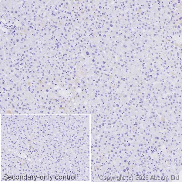 Immunohistochemistry (Formalin/PFA-fixed paraffin-embedded sections) - Anti-Cyclin E1 antibody [CCNE1/2460] - BSA and Azide free (AB237935)