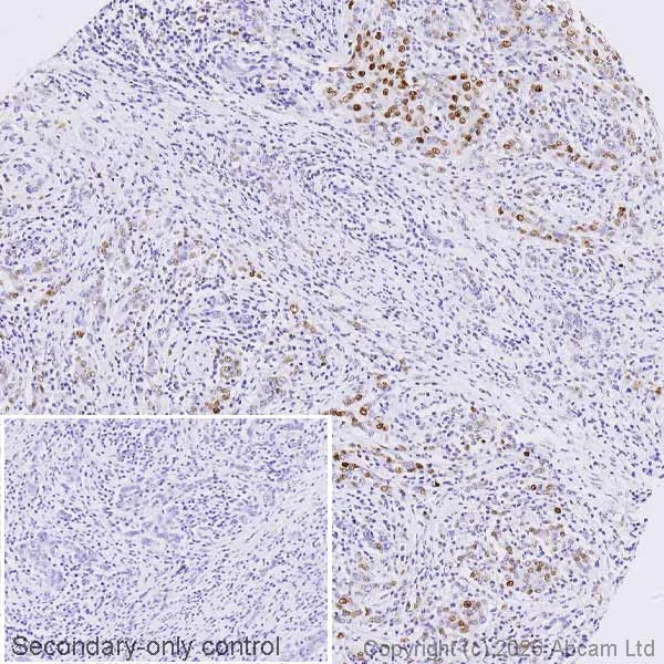 Immunohistochemistry (Formalin/PFA-fixed paraffin-embedded sections) - Anti-Cyclin E1 antibody [CCNE1/2460] - BSA and Azide free (AB237935)