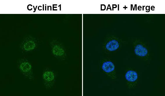 Immunocytochemistry/ Immunofluorescence - Anti-Cyclin E1 antibody [EP435E] - BSA and Azide free (AB208696)