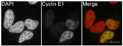 Immunocytochemistry/ Immunofluorescence - Anti-Cyclin E1 antibody [EP435E] - BSA and Azide free (ab208696), expandable thumbnail