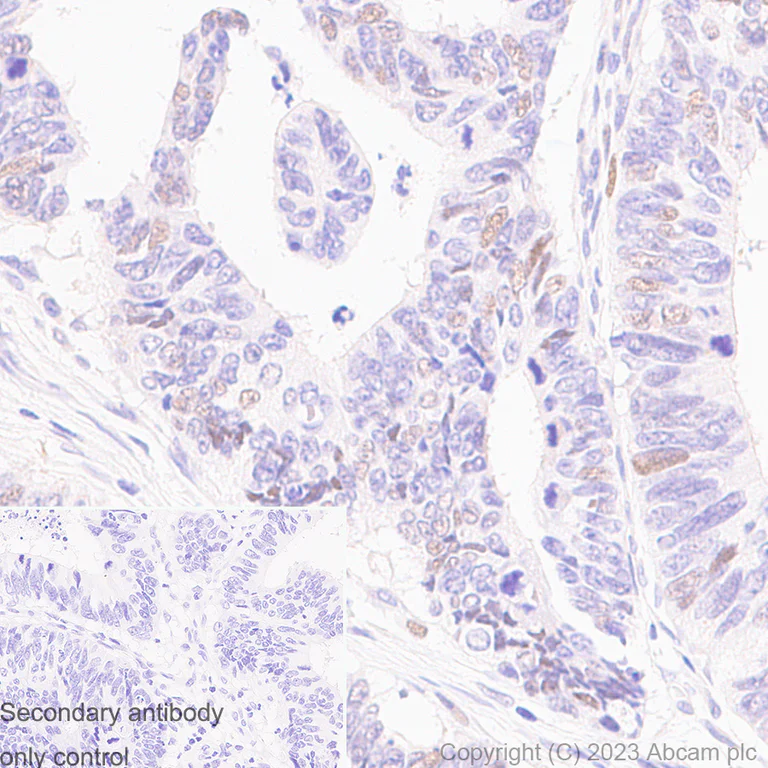 Immunohistochemistry (Formalin/PFA-fixed paraffin-embedded sections) - Anti-Cyclin E1 antibody [EP435E] - BSA and Azide free (AB208696)