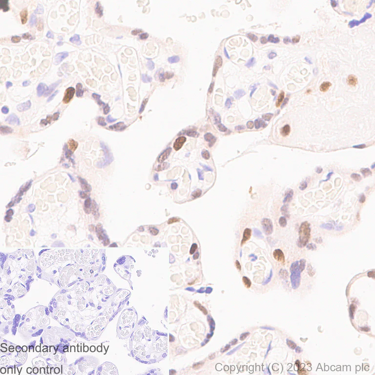 Immunohistochemistry (Formalin/PFA-fixed paraffin-embedded sections) - Anti-Cyclin E1 antibody [EP435E] - BSA and Azide free (AB208696)