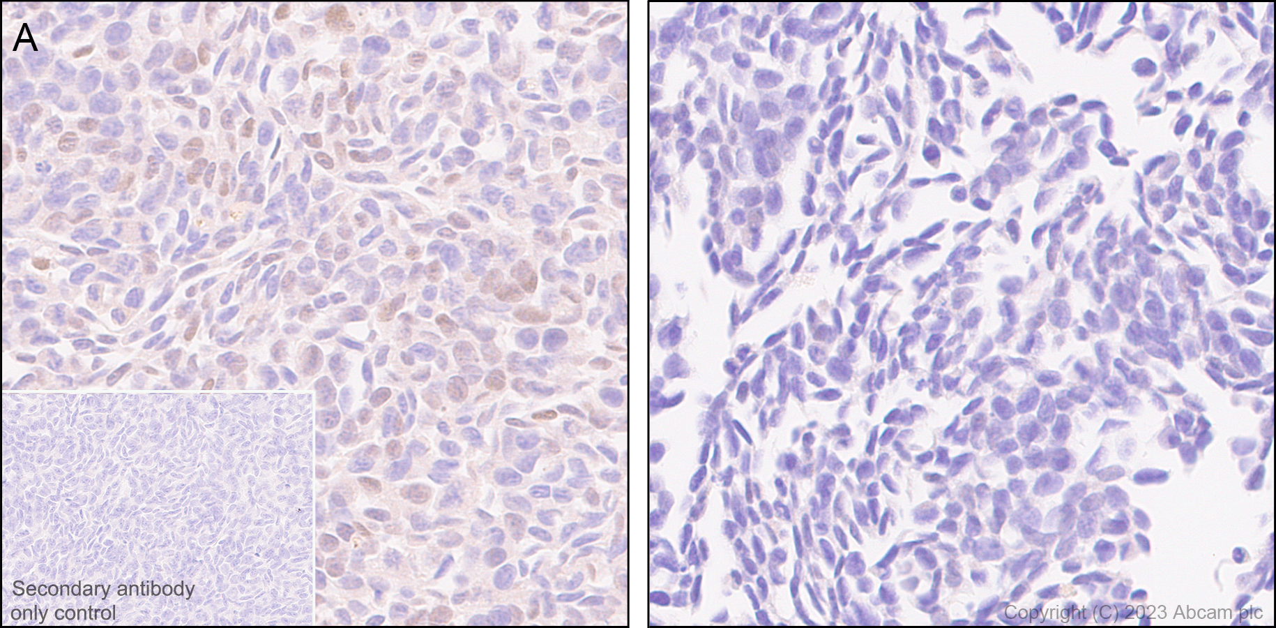 Immunohistochemistry (Formalin/PFA-fixed paraffin-embedded sections) - Anti-Cyclin E1 antibody [EP435E] - BSA and Azide free (ab208696), expandable thumbnail