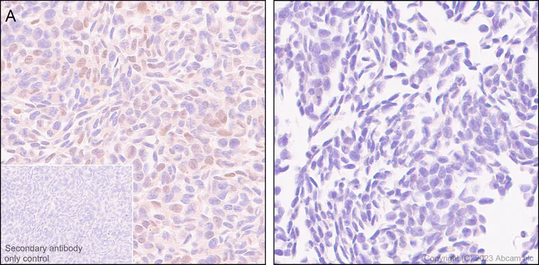 Immunohistochemistry (Formalin/PFA-fixed paraffin-embedded sections) - Anti-Cyclin E1 antibody [EP435E] - BSA and Azide free (AB208696)