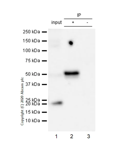 Immunoprecipitation - Anti-Cyclin E1 antibody [EP435E] - BSA and Azide free (AB208696)